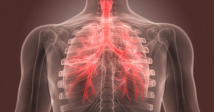 signs-and-symptoms-of-bronchitis