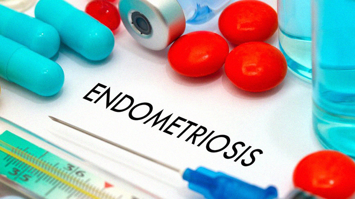 latest research for endometriosis